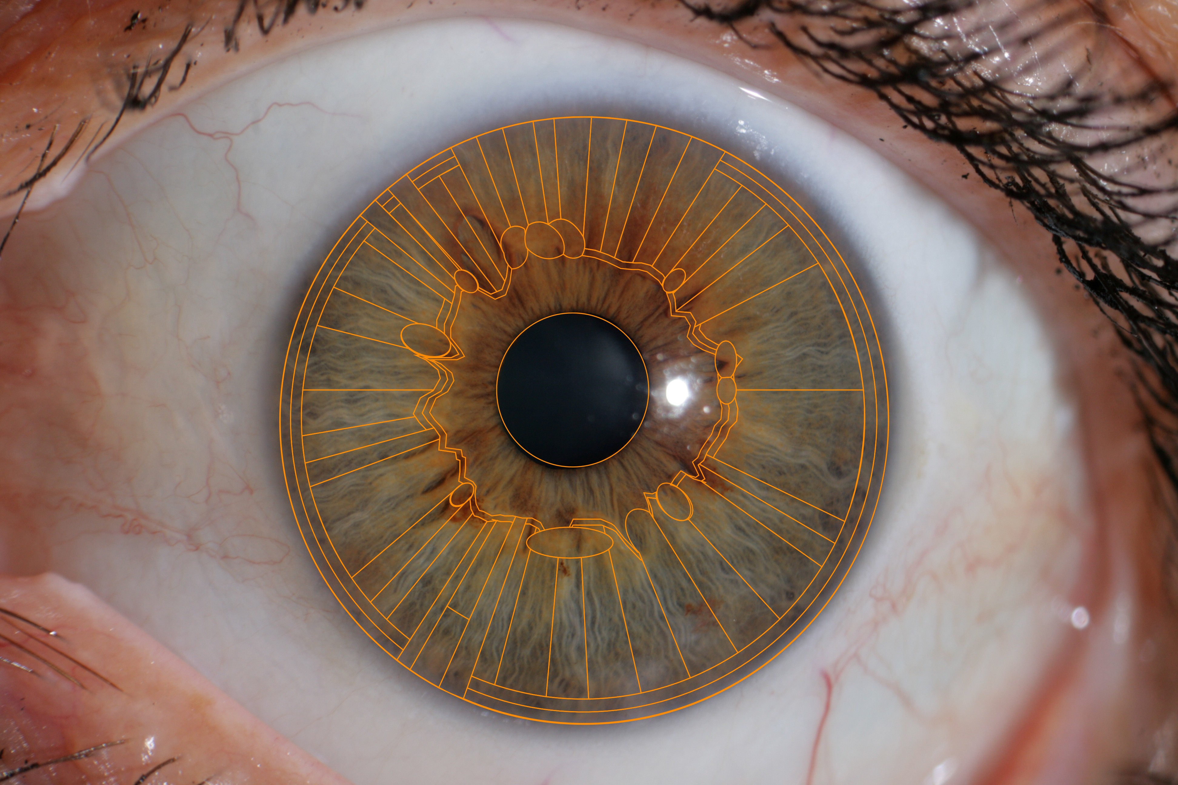 Iridology Chart Overlay